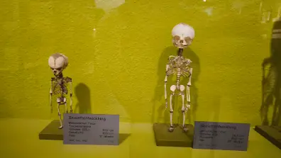 Basel - Anatomisches Museum der Universität Basel